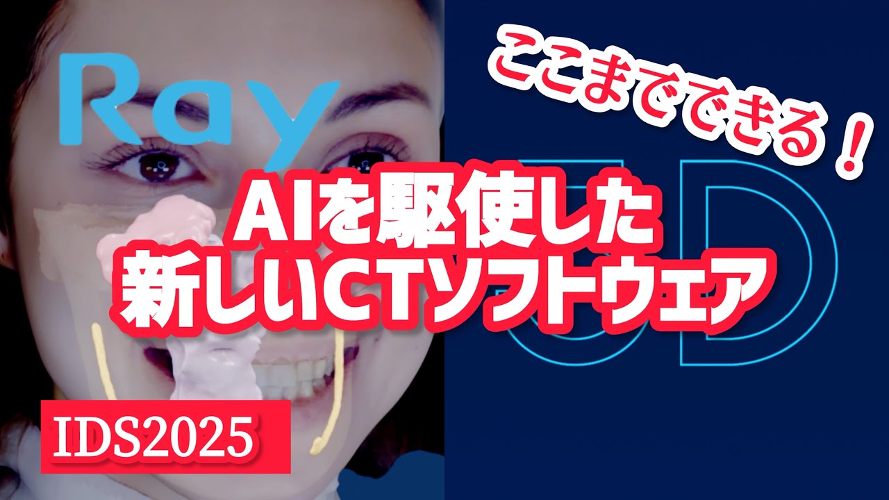 Rayの新しい5Dコンセプト「AIによる自動セグメンテーション」上顎洞、歯髄、気道、下歯槽管を全て抽出