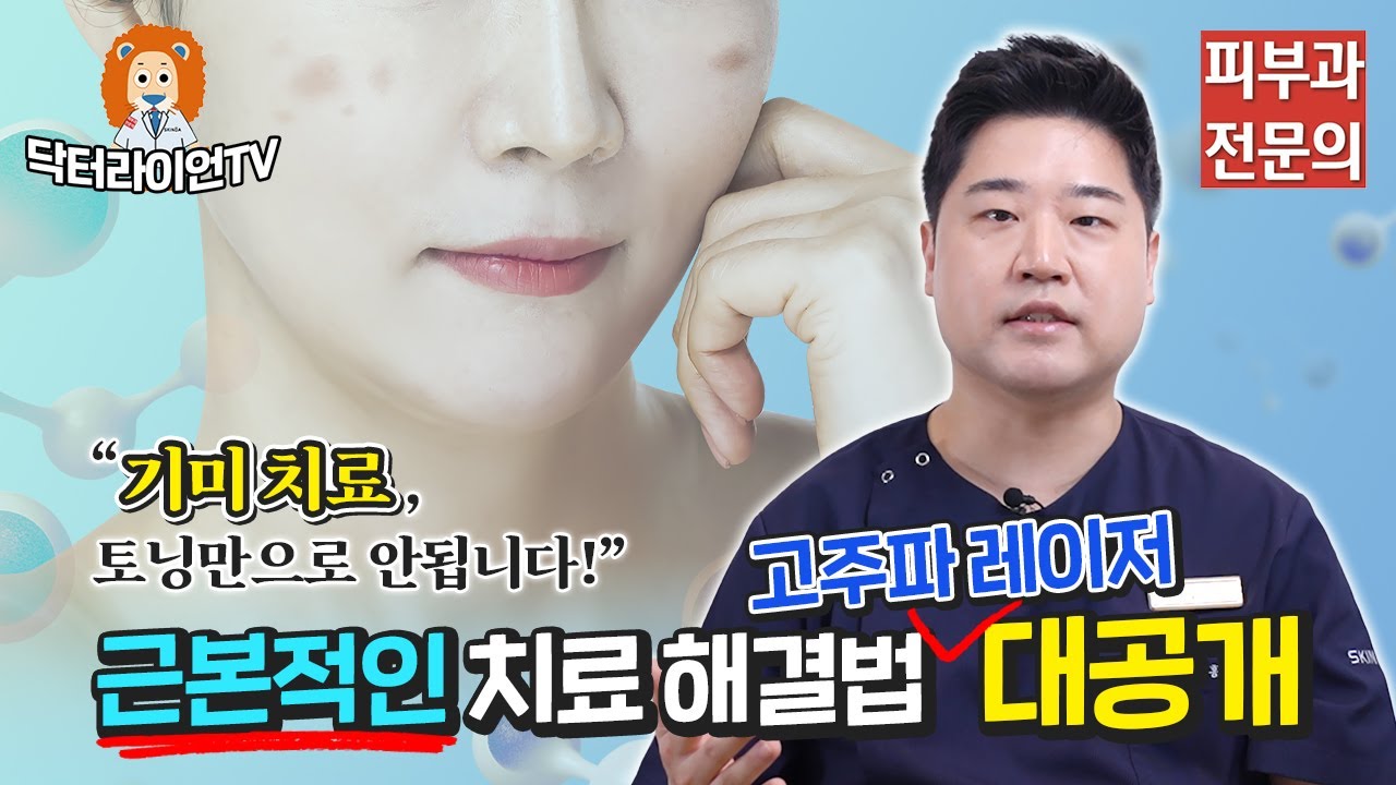 [기미정복 2탄!] 근본적인 기미 치료/기미 부작용 치료 해결법 