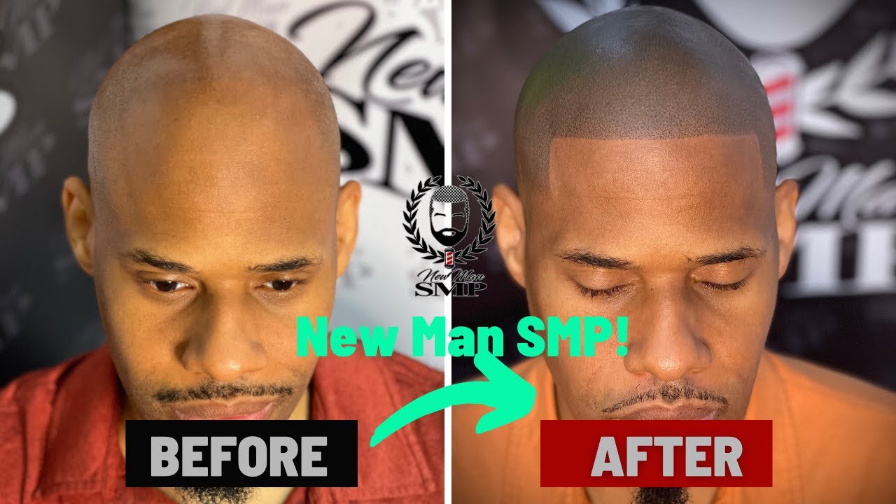 New Man SMP Review | Atlanta’s Finest in Scalp Micropigmentation