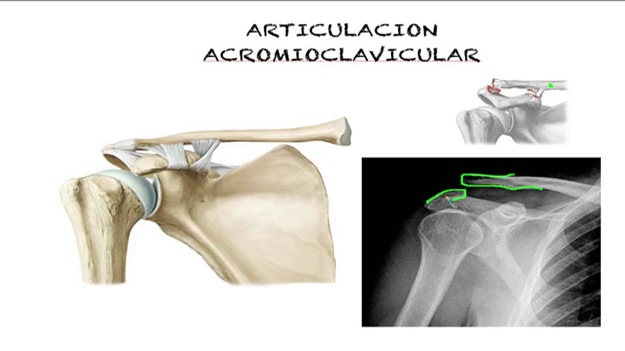 Complejo articular de hombro