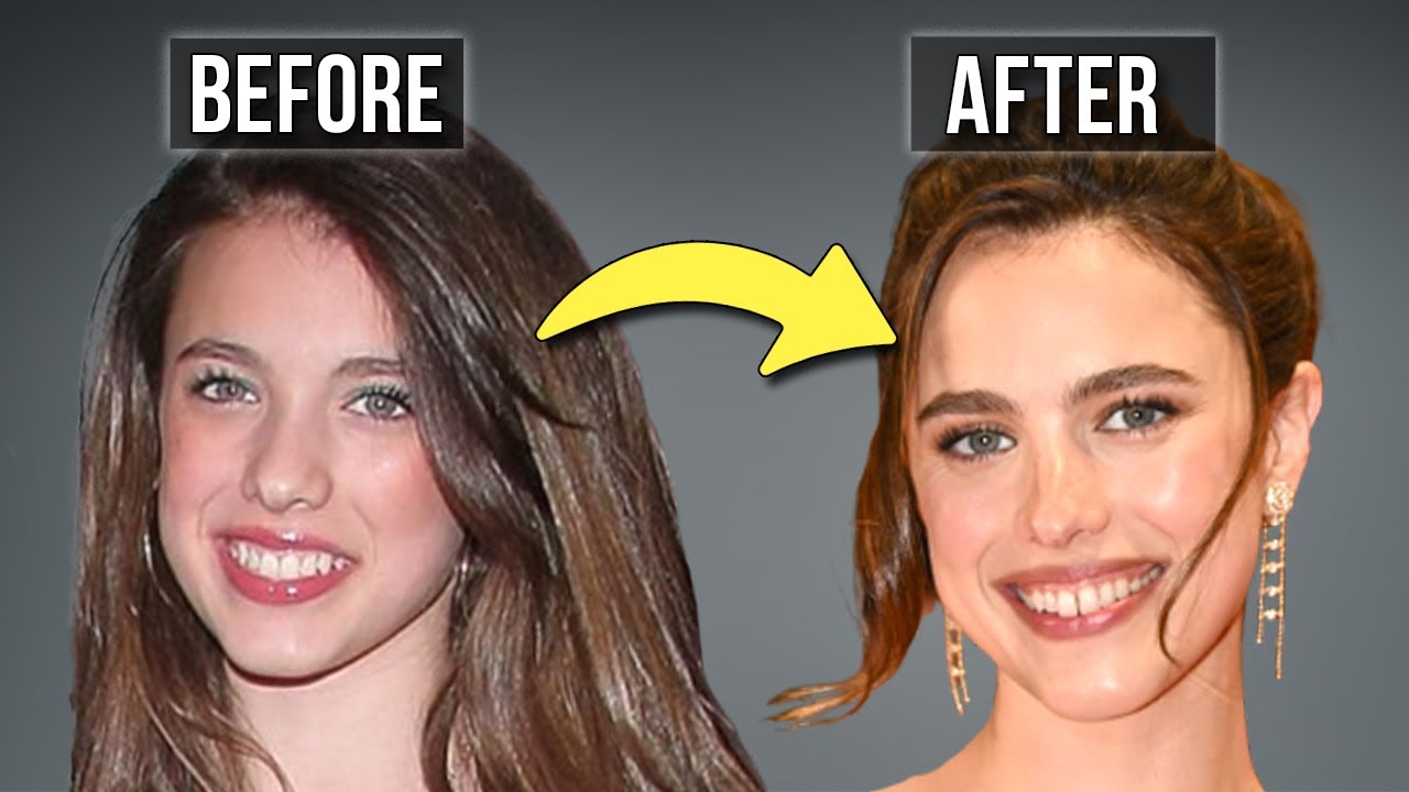 I Was Wrong About Margaret Qualley Being Natural; the Plastic Surgery I Missed...