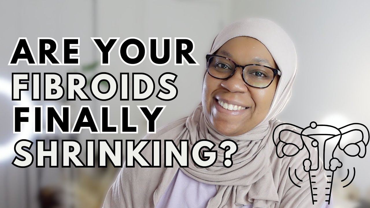 Signs Your Fibroids Are Shrinking!