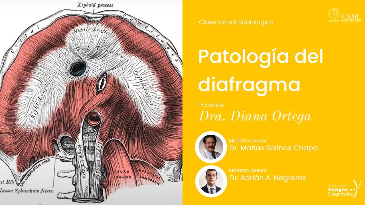 Patología del diafragma por la Dra. Diana Ortega