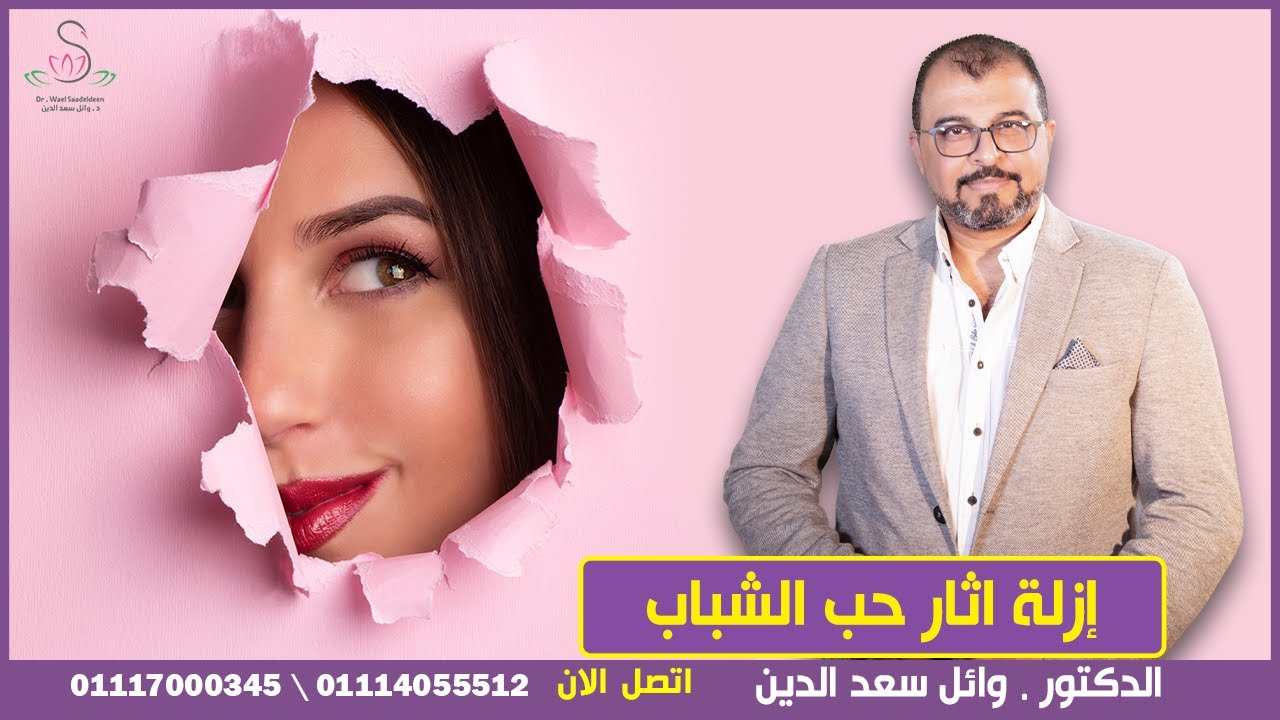 ازالة أثار حب الشباب نهائيا \ بإجراءات حديثة تحافظ على بشرتك من خلال مركز \ الدكتور وائل سعد الدين