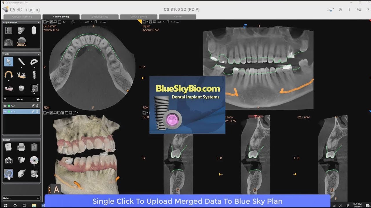 CS 3D Imaging Blue Sky Integration