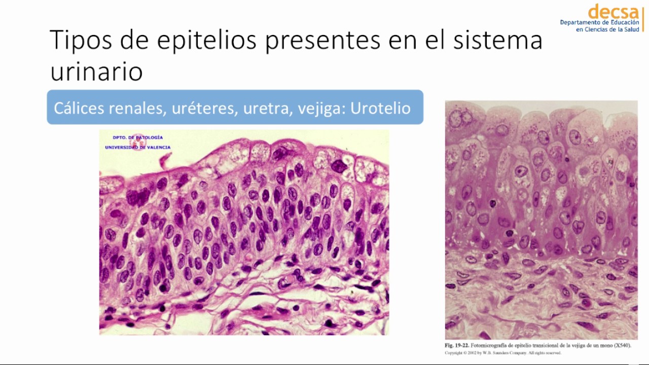 Sistema Urinario
