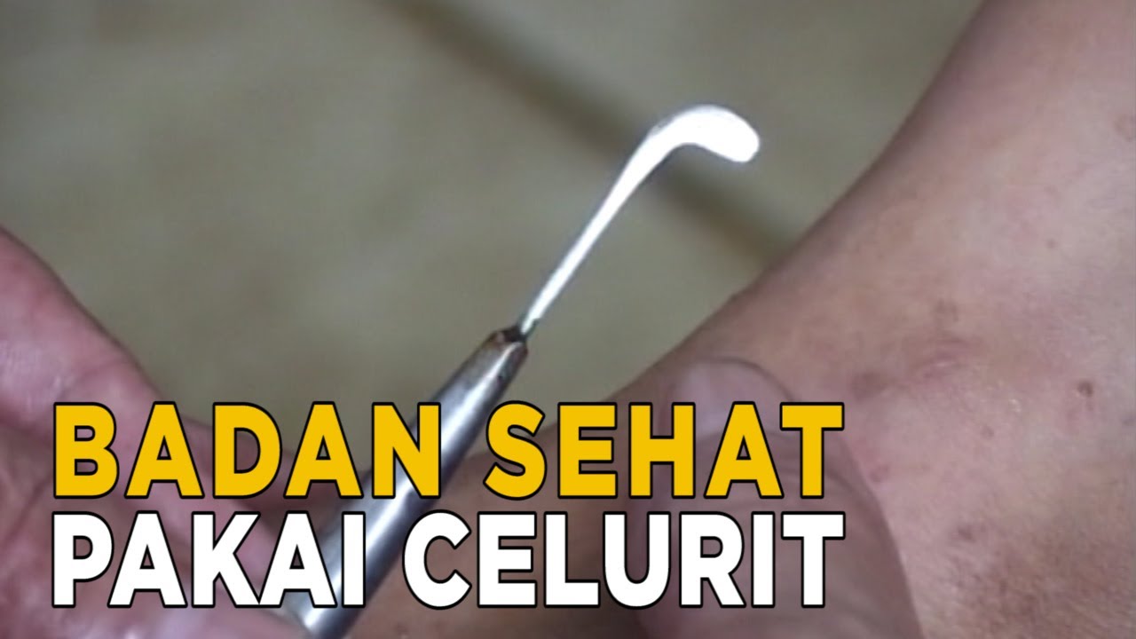Badan sehat dengan terapi unik menggunakan media celurit mini | SISI LAIN
