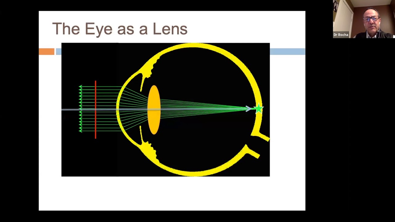 Pushing the Limits in the Surgical Correction of Keratoconus - Dr. Guillermo Rocha