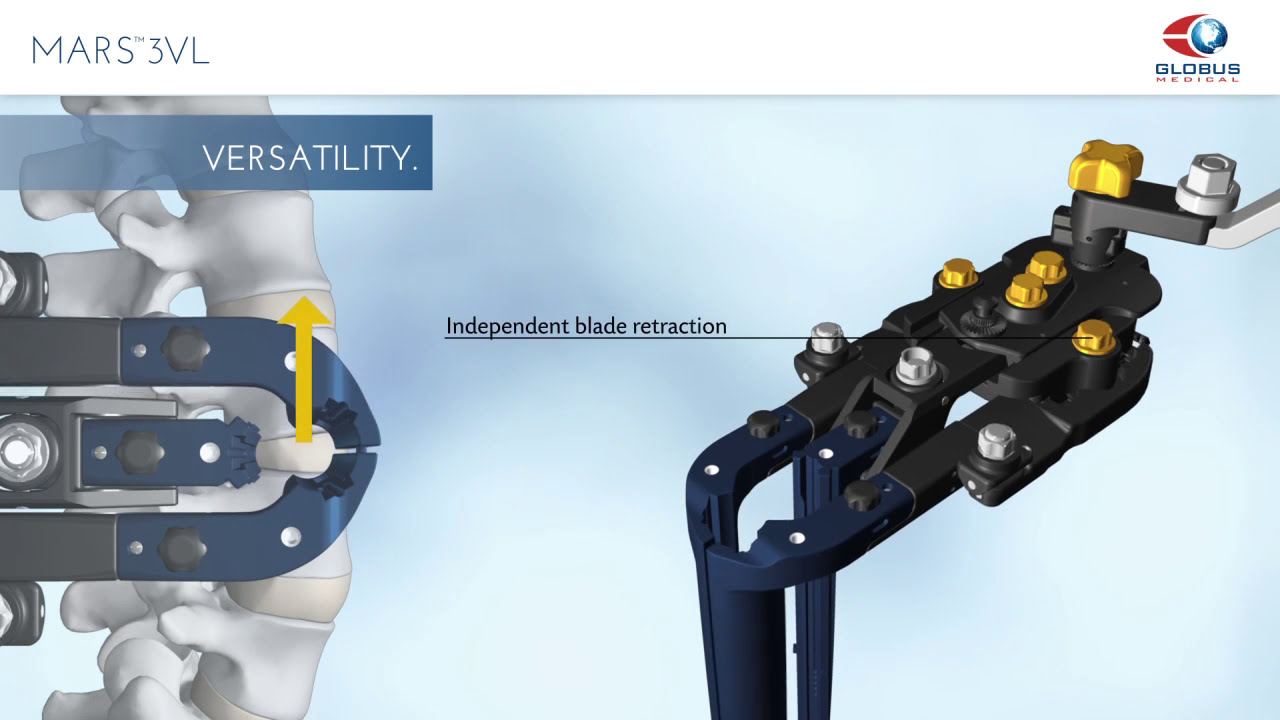 MARS™3VL Retractor