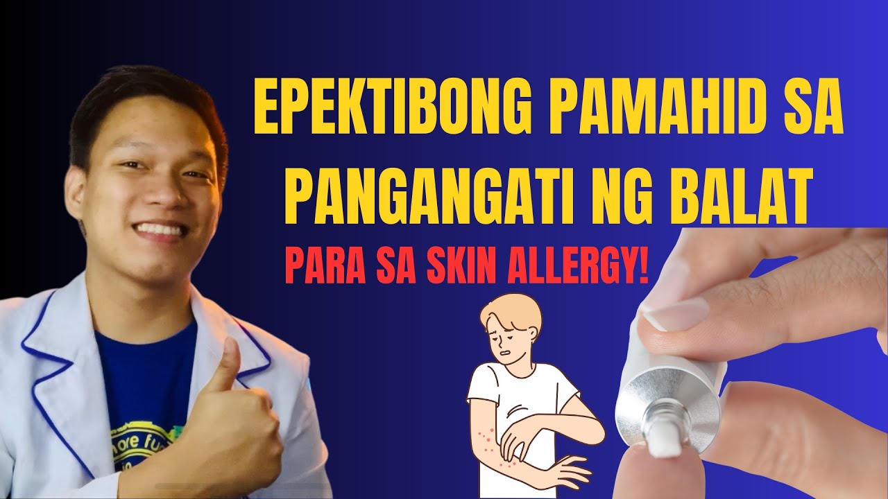 PAMAHID PARA SA SKIN ALLERGY AT PANGANGATI