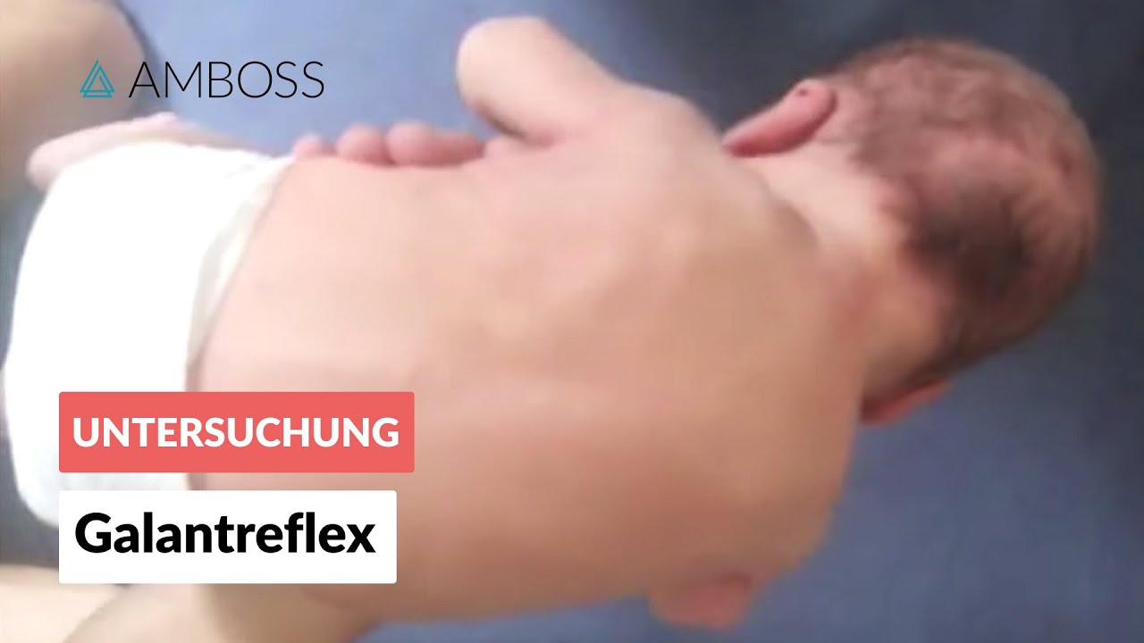 Galantreflex - Frühkindliche Reflexe - AMBOSS Video