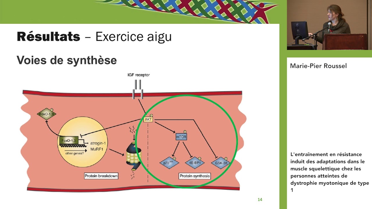 Dystrophie myotonique de type 1 (DM1) avec Marie-Pier Roussel | DMC - MDC