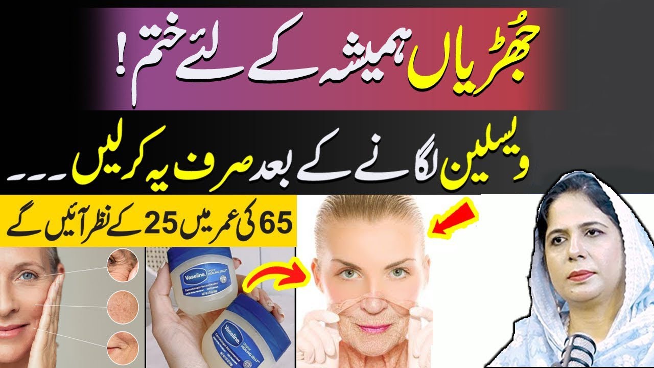 Chehray Ki Juriyan Hamesha Kay Liye Khatam I Naima Apa