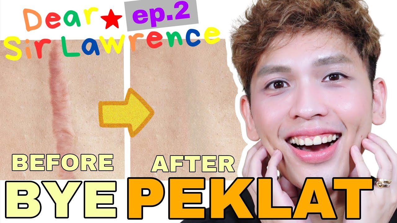 PAANO MAWALA ANG PEKLAT / SCARS? 