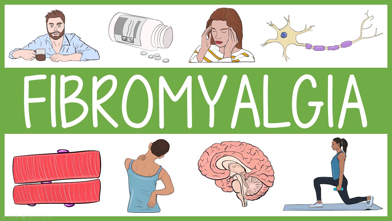 Fibromyalgia Visually Explained