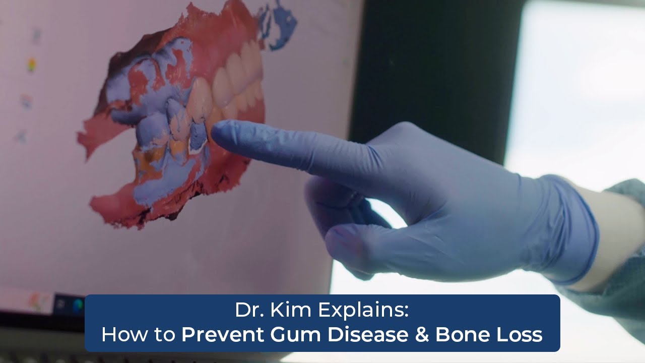 Dr. Kim Explains: How to Prevent Gum Disease & Bone Loss