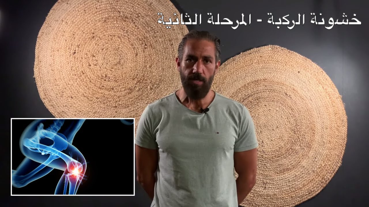 ١٨- علاج خشونة الركبة, تآكل الغضروف, الفصال العظامي, التهاب المفاصل - سوفان الركبة - المرحلة الثانية