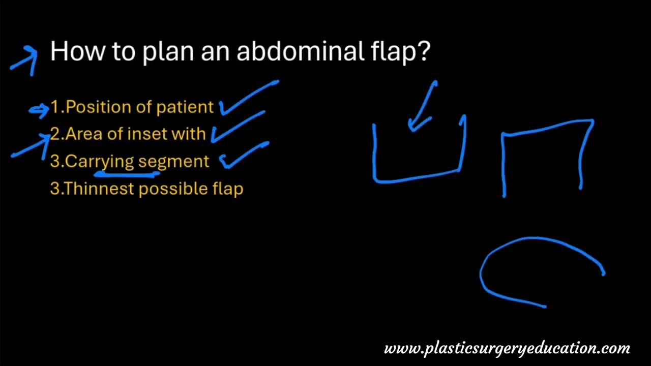 Планирование абдоминальных лоскутов и их васкуляризация.