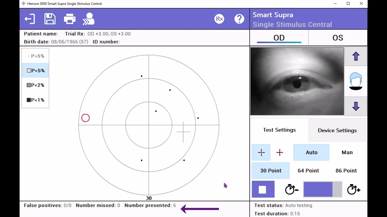 Operating the Henson 9000’s rapid and intelligent screening test: Smart Supra Single Stimulus