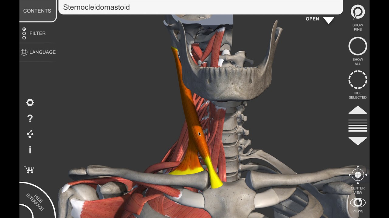 Musculus sternocleidomastoideus (hoofdpijn / migraine / duizeligheid)