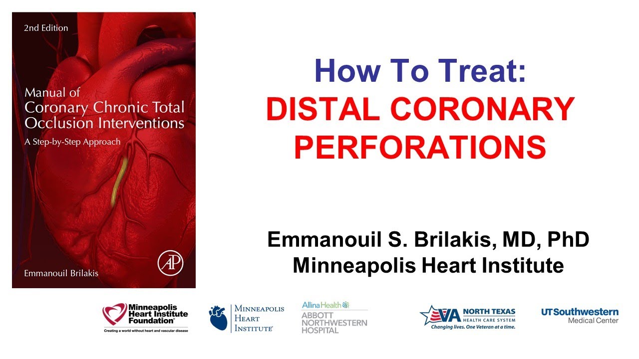 How to treat distal coronary perforations