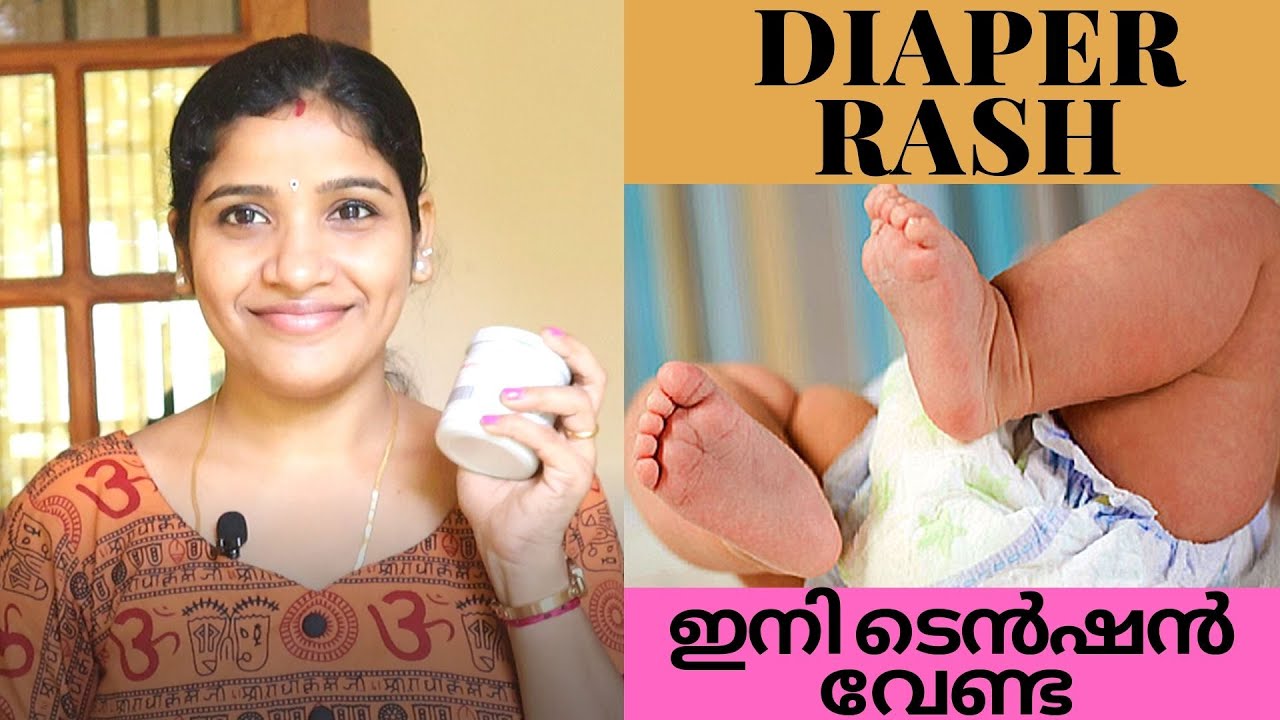 Diaper Rash Treatment Prevention and Remedies Malayalam|Best Diaper Rash Cream