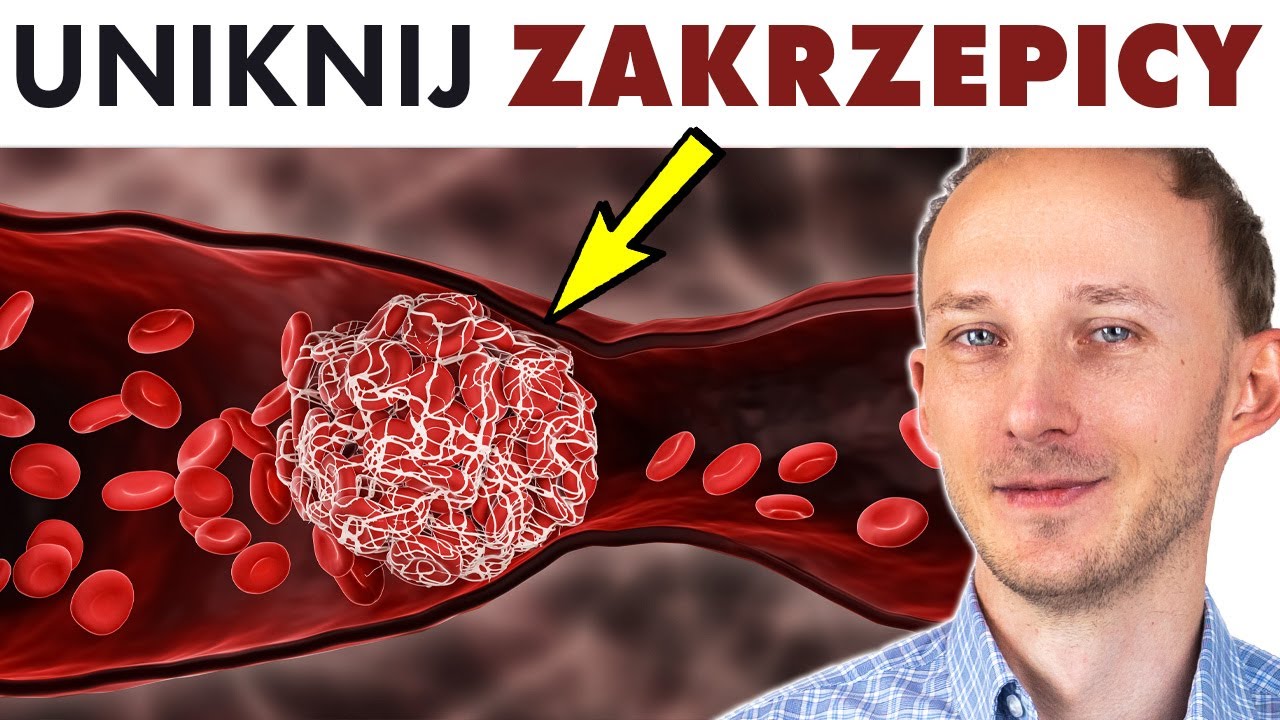 Tak unikniesz zablokowania żył skrzepami 🩸 Czego nie jeść i co robić. Zakrzepica