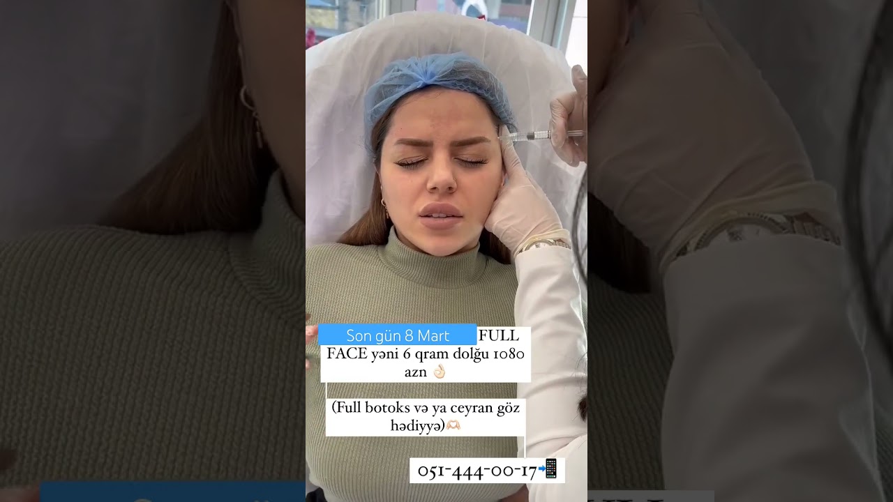 Qəbula yazılmağa tələsin 🤩 #NigarSultanova #estetik #botox #dolgu