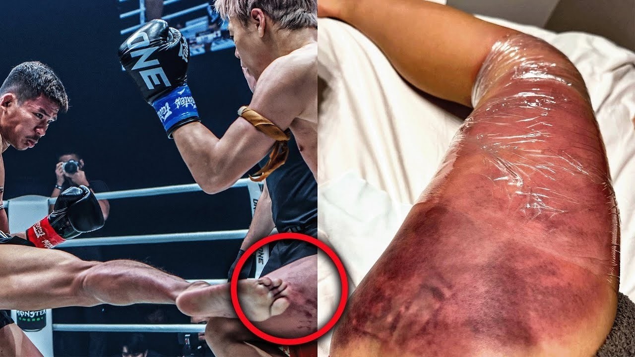 THE MOST VICIOUS LEG KICKS IN FIGHT HISTORY | THIS WAS A LEG KICK SLAUGHTER 💀😱