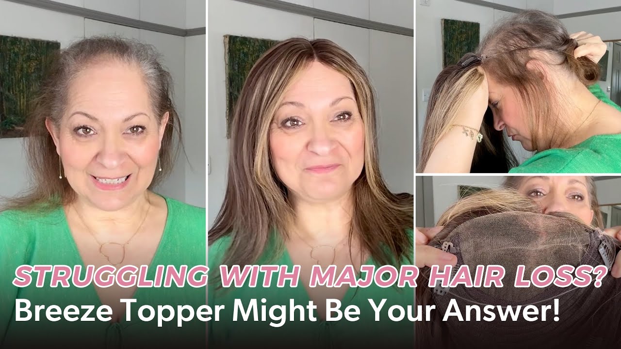 Struggling with Major Hair Loss? Breeze Topper Might Be Your Answer! | UniWigs Breeze