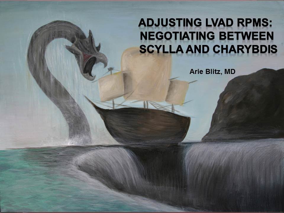 VAD RPM:  Negotiating between Scylla and Charybdis.   Blitz