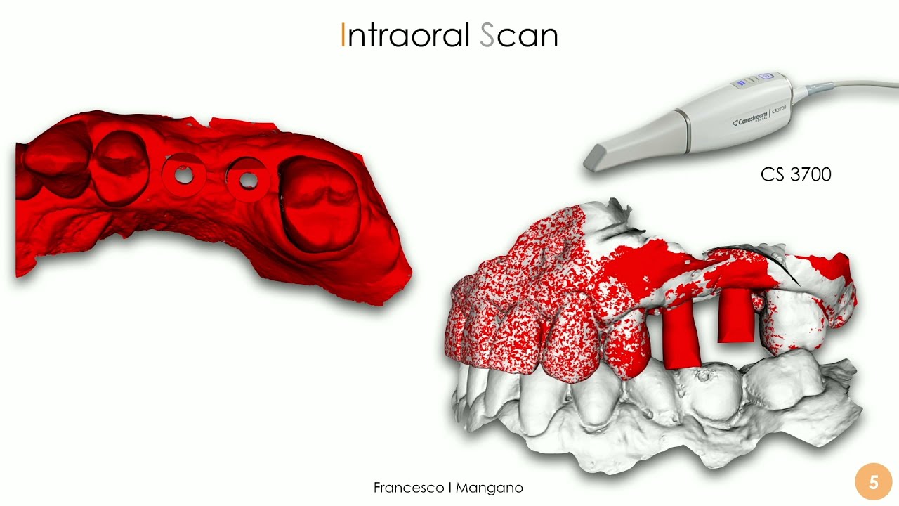 ESSENTIALS of DIGITAL DENTISTRY- #Make!- Video 27