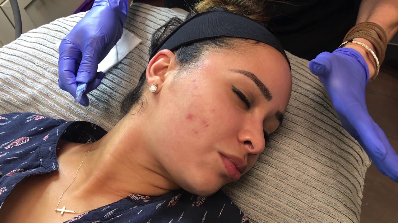 Dermaplaning with Melanie