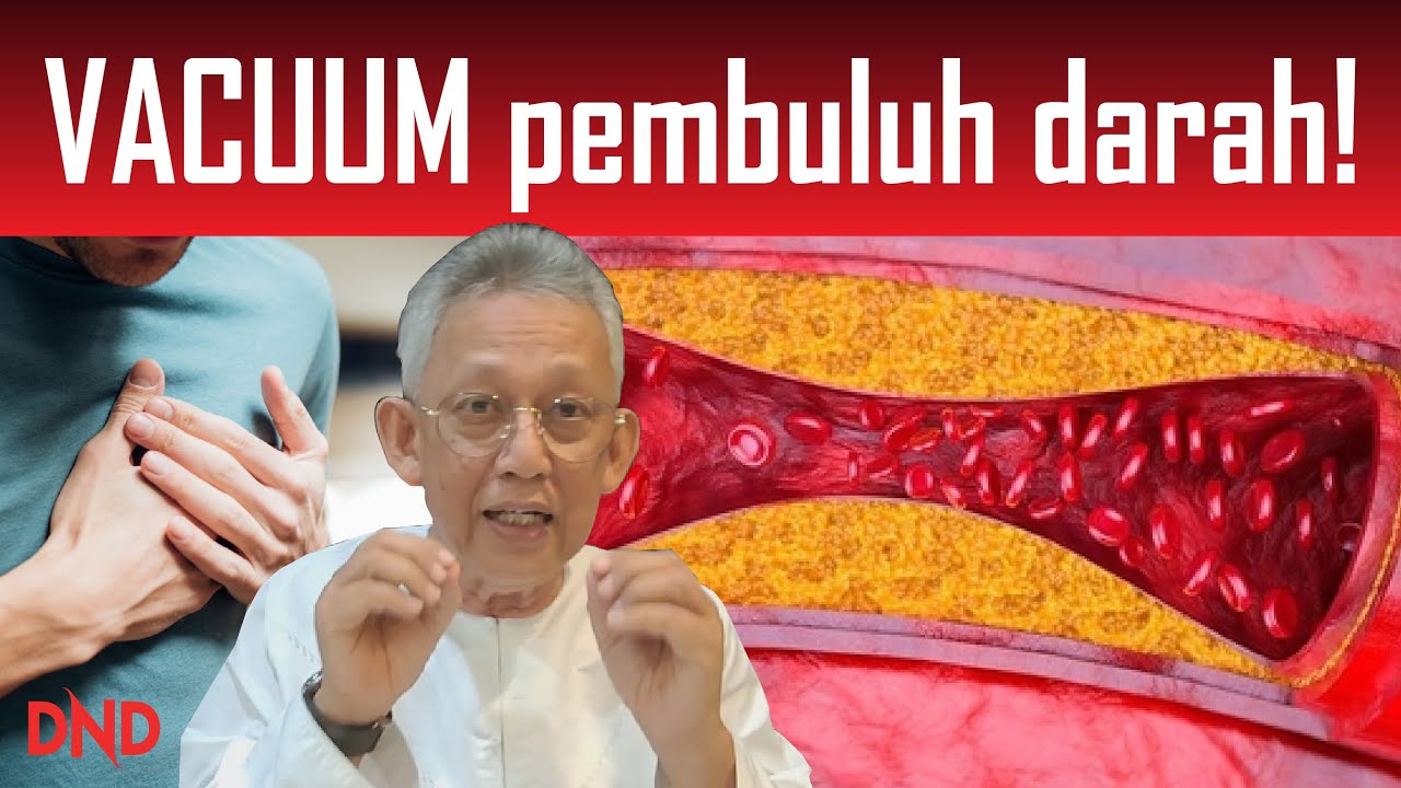 HEART ATTACK! Bagaimana nak VACUUM Pembuluh Darah kita!