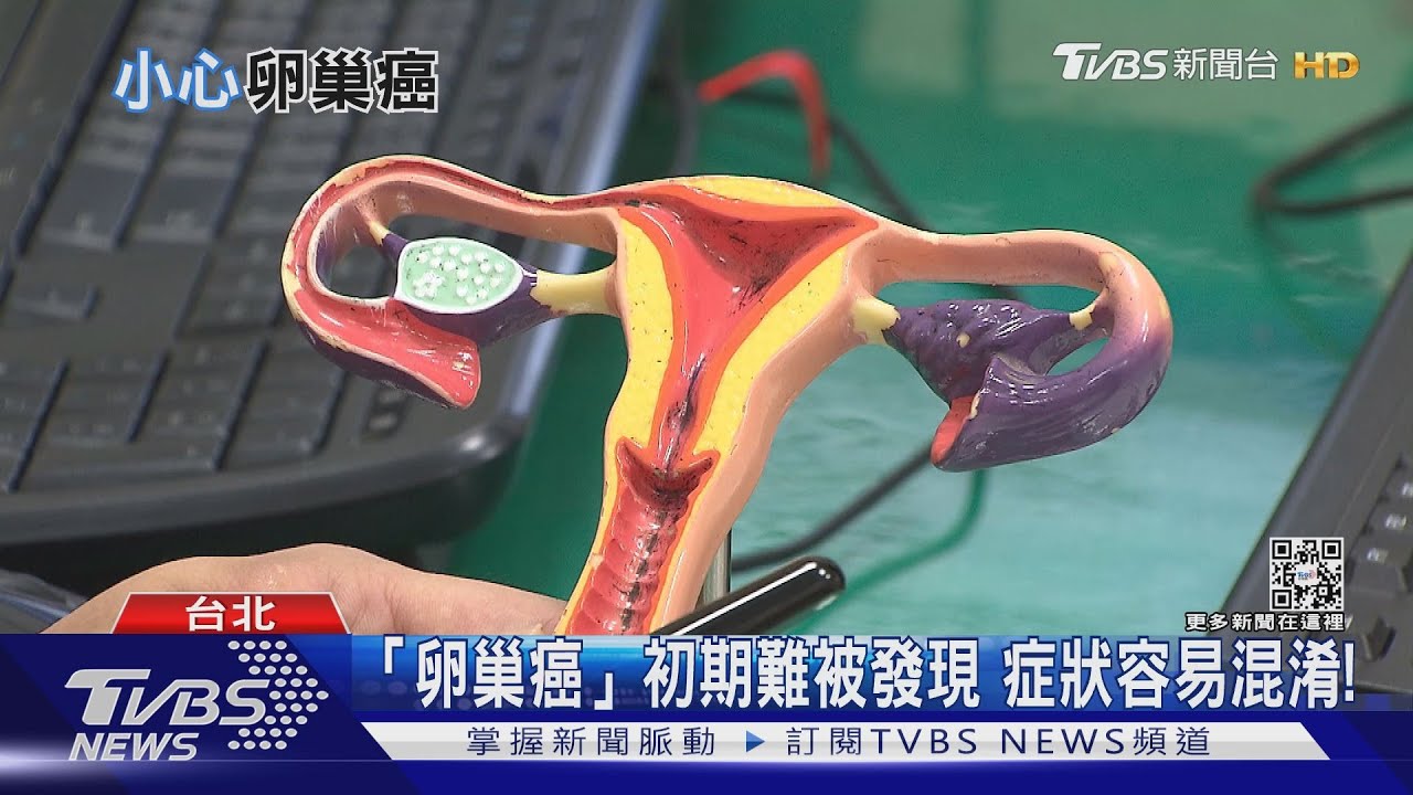 您是「卵巢癌」高風險族群嗎? 體內驗出這個基因罹癌風險高!｜十點不一樣20211223