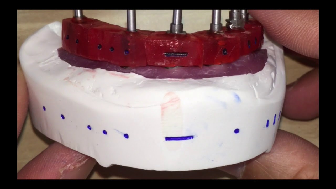 Easy Acrylic Verification Jig