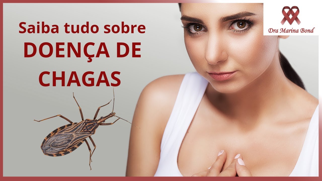 Tudo sobre Doen&ccedil;a de Chagas