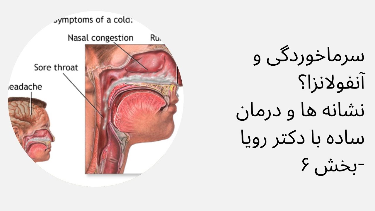 سرماخوردگی و آنفولانزا؟نشانه ها و درمان ساده با دکتر رویا بخش ۶