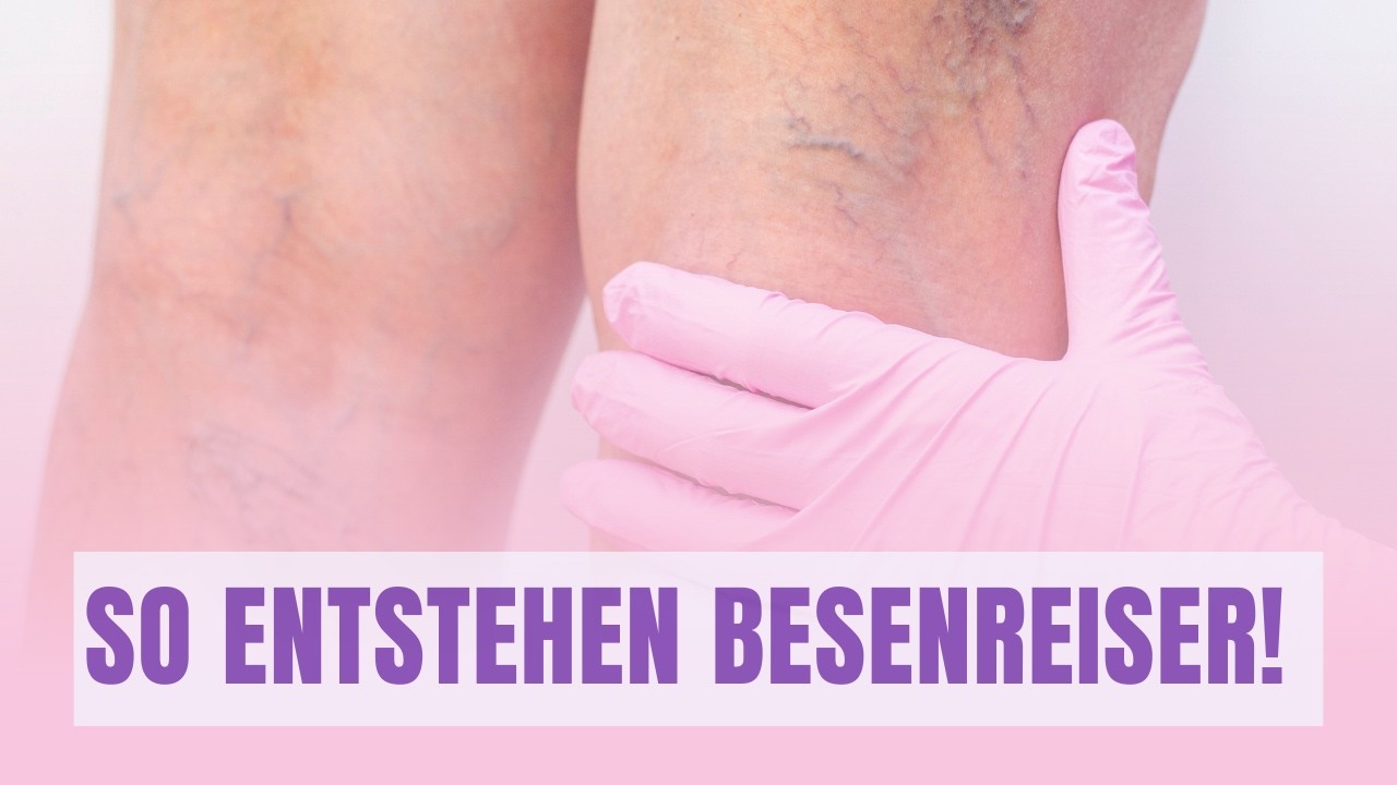 BESENREISER IM ÜBERBLICK | Dr. Sabetian klärt auf!