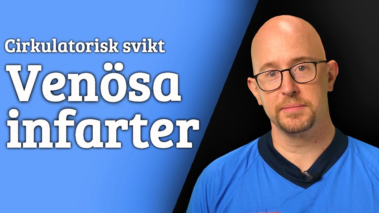 Cirkulatorisk svikt: Venösa infarter