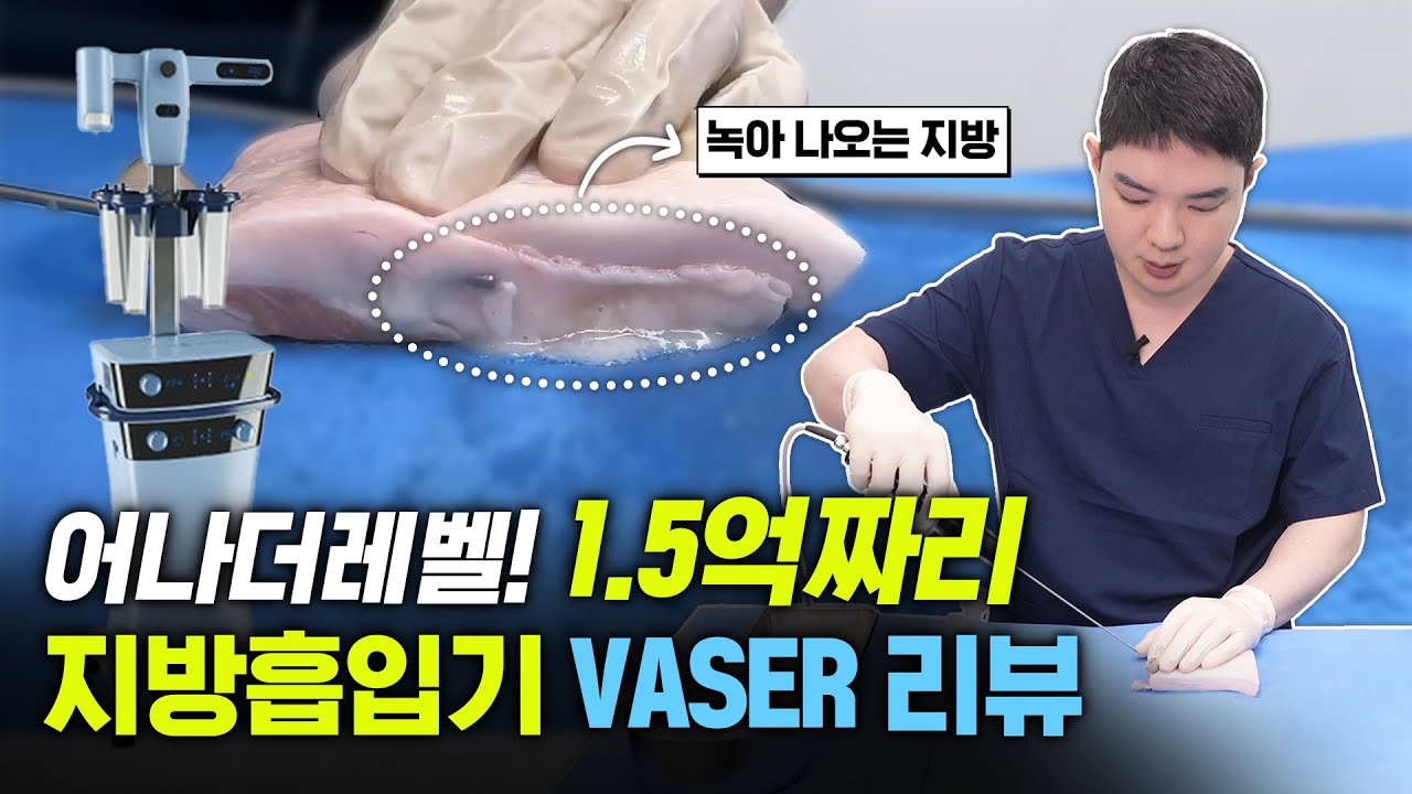 “지방을 아예 녹여없애는 초음파 지방흡입기” 억소리나는 1.5억 짜리 초음파 지방흡입기 VASER 리뷰!
