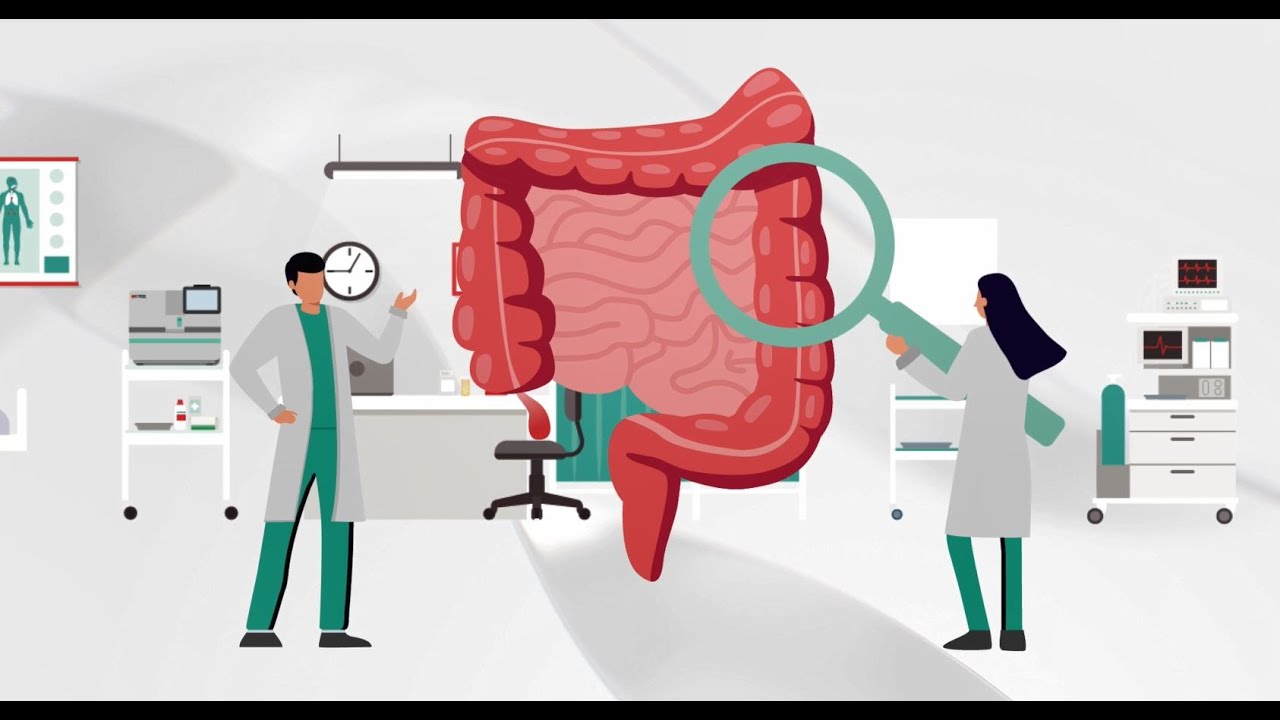 Colorectal Cancer Screening: Fecal Immunochemical Test (FIT) | OC-SENSOR