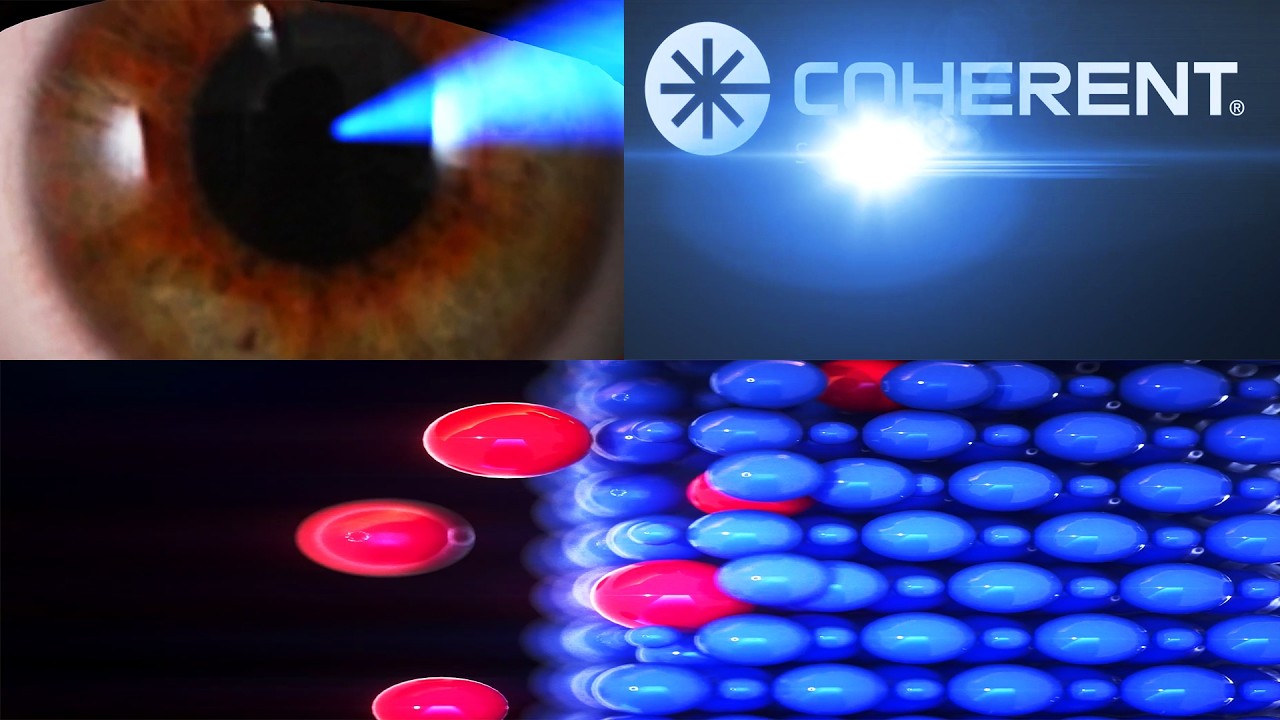 Почему акции (Coherent) $COHR становятся еще популярнее