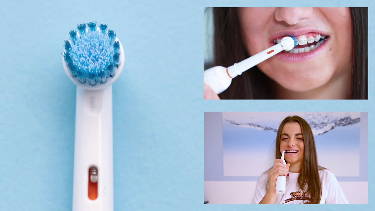 Video Tutorial Igiene orale durante il trattamento ortodontico