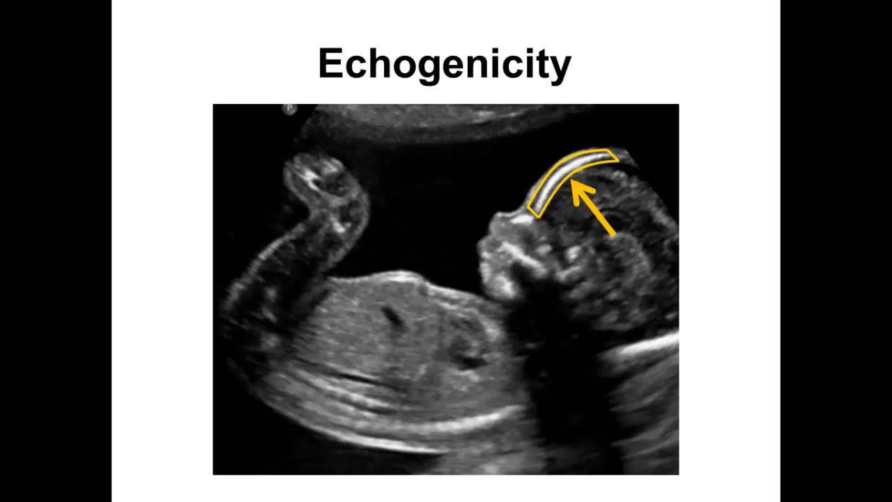 Introduction to Ultrasound - 01 - Fundamentals