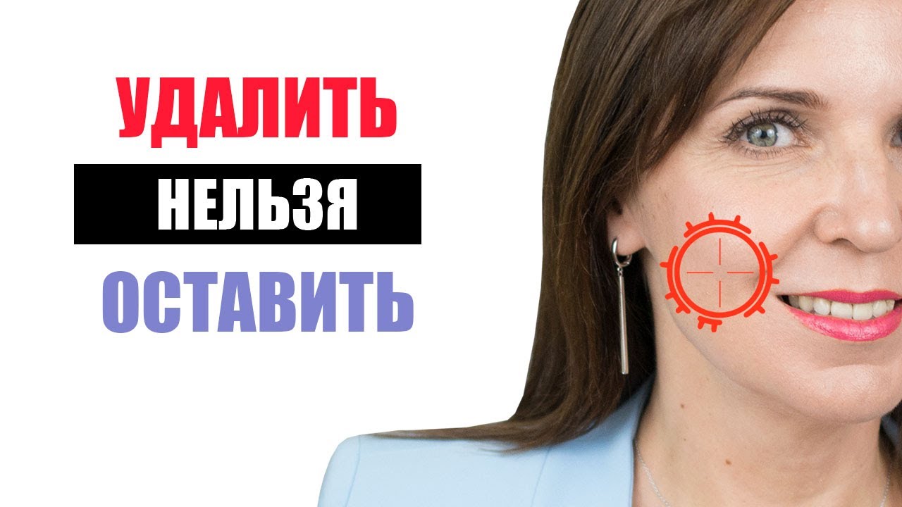 Как убрать Брыли и сделать Скулы - Удаление комков Биша