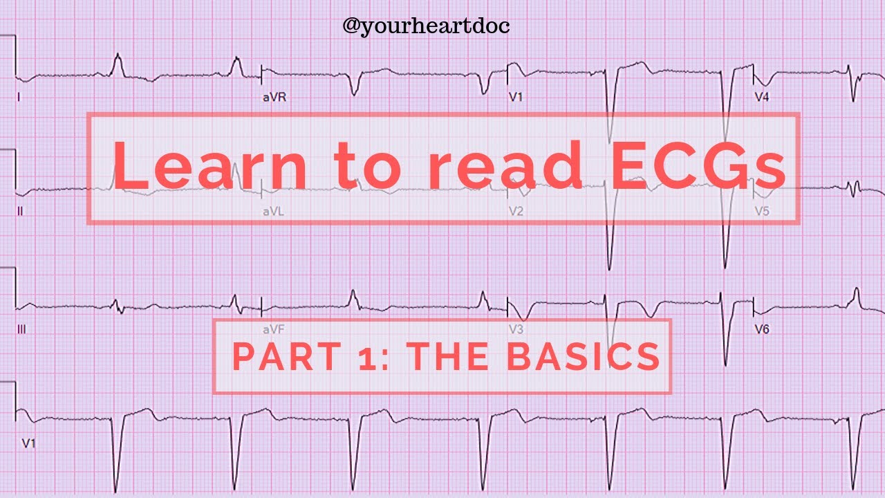 How to read an ECG / EKG Part 1. The Basics of understanding an electrocardiogram.