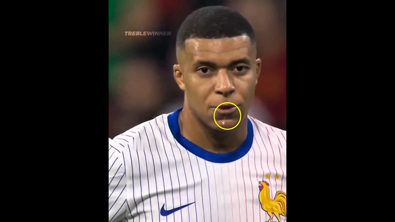 Players spitting 💀