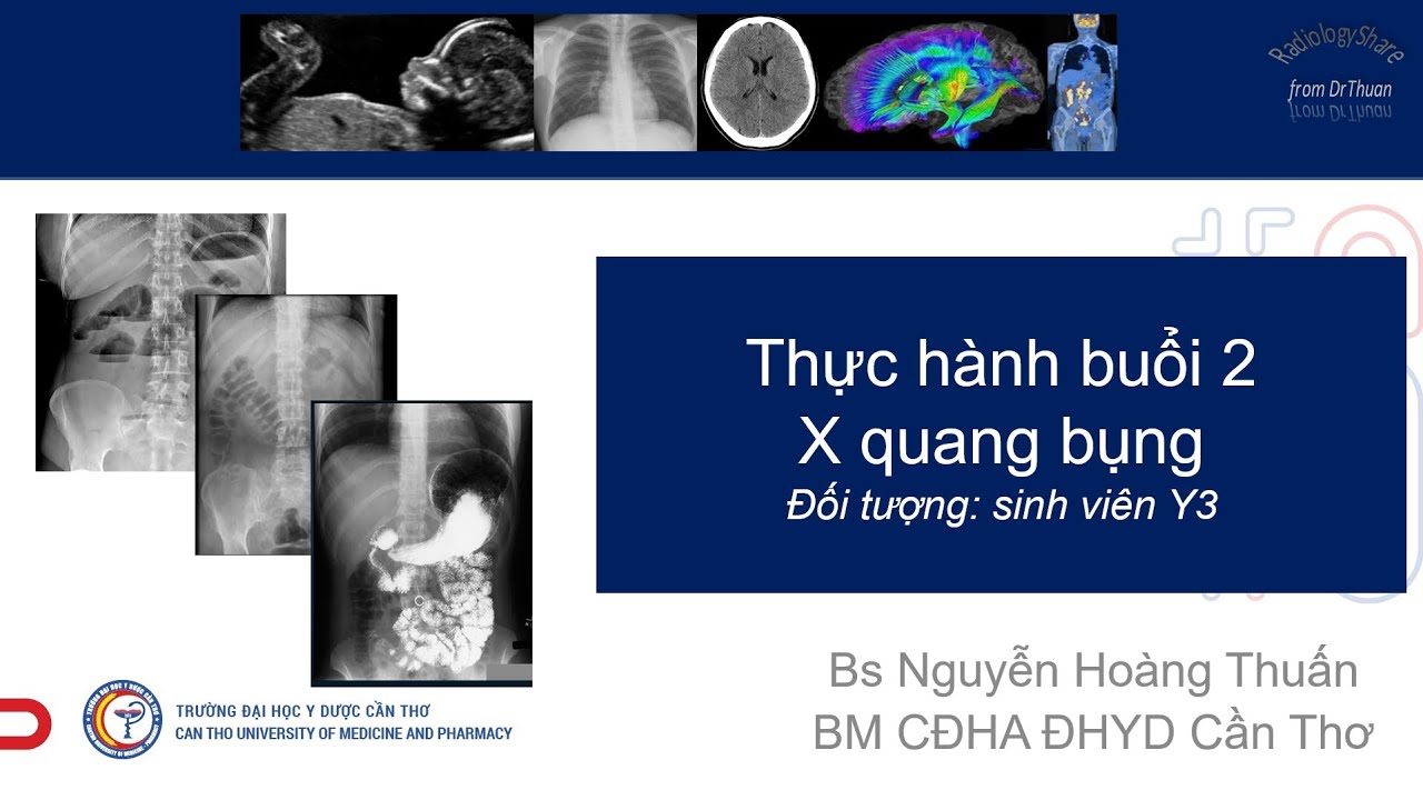 Thực hành buổi 2 - X quang bụng