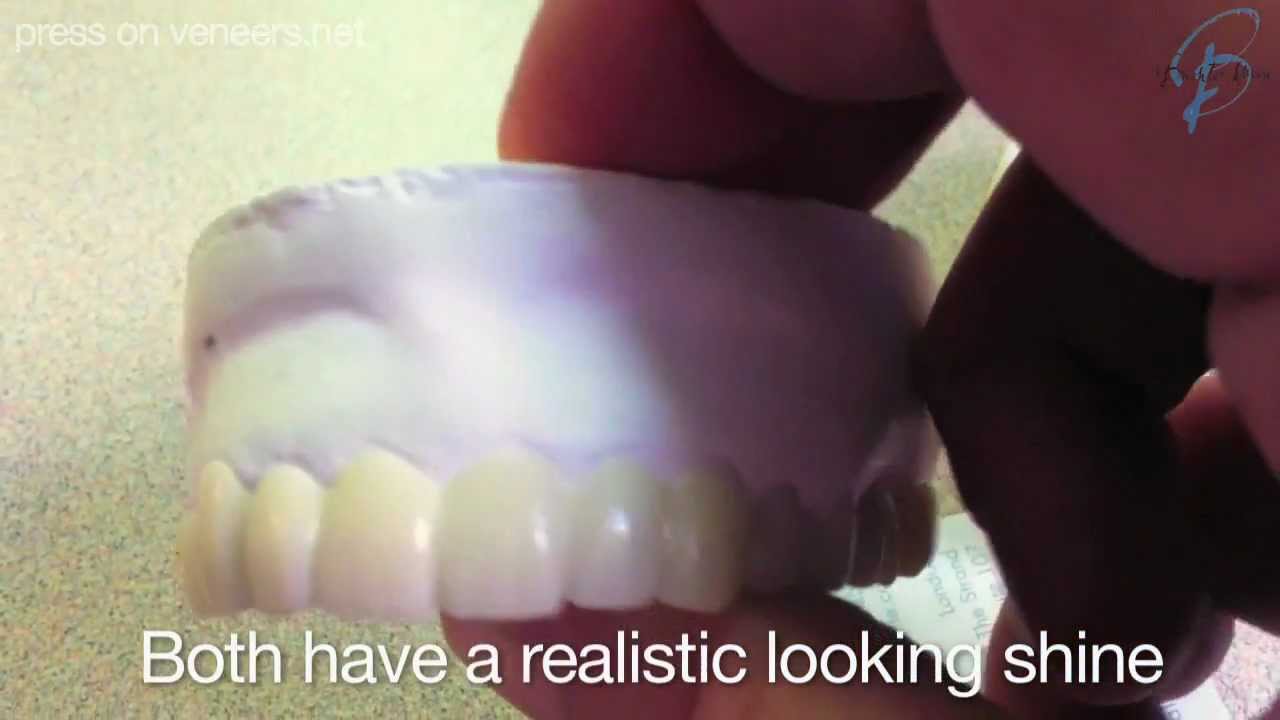 Snap On Smile vs. Press On Veneers - Smile Makeovers Compared